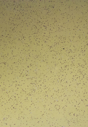 Clínica Diaverum – Almada – CastanFloor Chips – traço